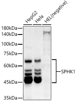 SPHK1 Monoclonal Antibody [2L6P4]