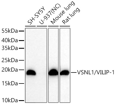 VSNL1/VILIP-1 Monoclonal Antibody [7A8R4]