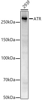 ATR Monoclonal Antibody [2C6D9]