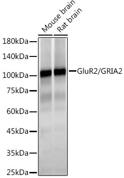 GluR2/GRIA2 Monoclonal Antibody [9E6H3]