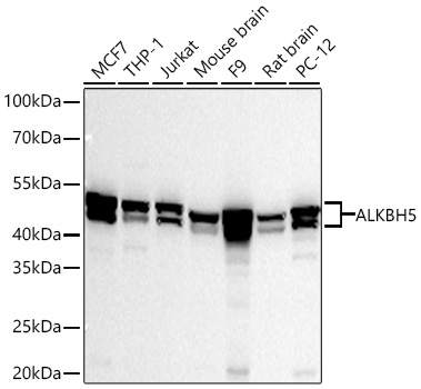 ALKBH5 Monoclonal Antibody [2S4Q6]