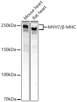 MYH7/B-MHC Monoclonal Antibody