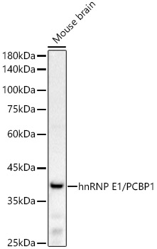 hnRNP E1/PCBP1 Monoclonal Antibody [7Y8C5]