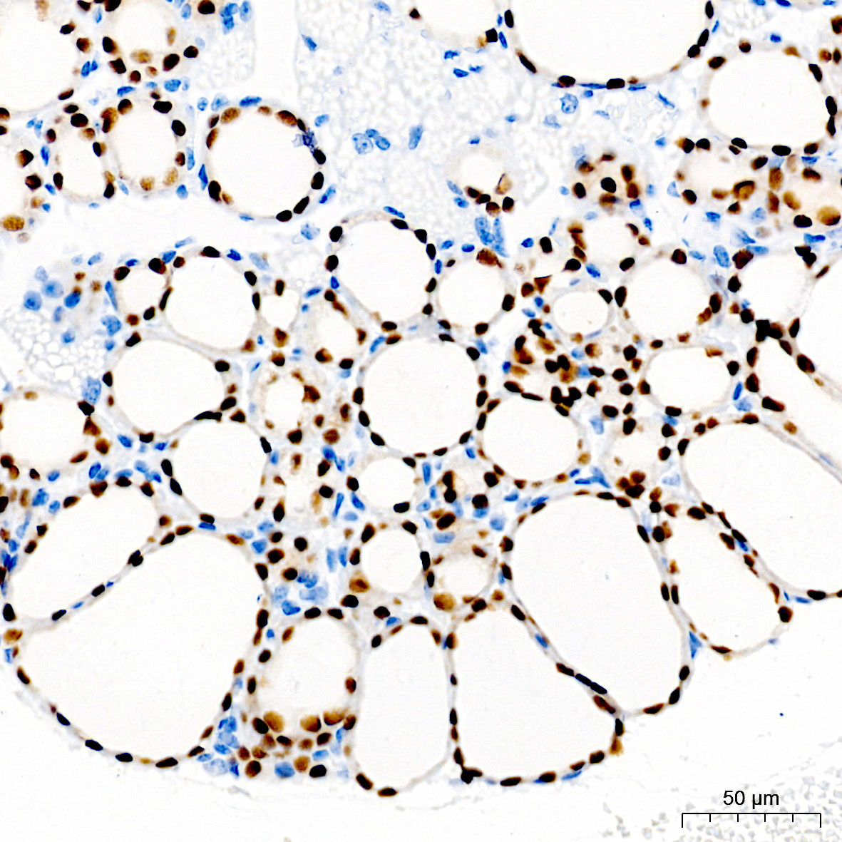 PAX8 Monoclonal Antibody [8J3L1]
