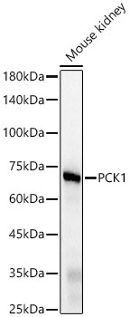 PCK1 Monoclonal Antibody