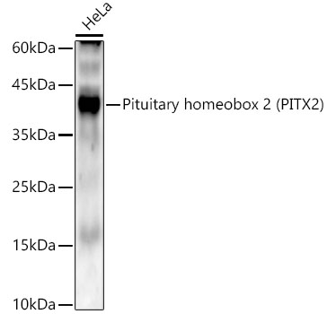 Pituitary homeobox 2 (PITX2) Monoclonal Antibody [6X1W3]