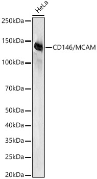 CD146/MCAM Monoclonal Antibody [1O4Y6]
