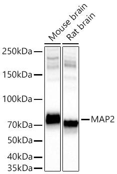 MAP2 Monoclonal Antibody [2W0O8]