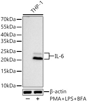 IL-6 Monoclonal Antibody [8Q9I8]