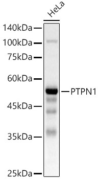 PTPN1 Polyclonal Antibody