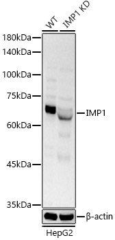 IGF2BP1/IMP1 Polyclonal Antibody