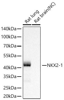 NKX2-1 Monoclonal Antibody [6L7L3]