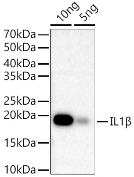 IL1B Monoclonal Antibody [6E5T2]