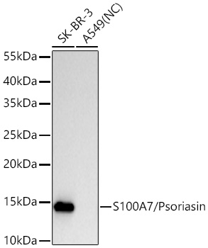 S100A7/Psoriasin Monoclonal Antibody [7G4P7]