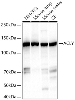 ACLY Monoclonal Antibody [2N2W3]&nbsp;<img src="images/icon_newarrival.gif" alt="new" border="0">