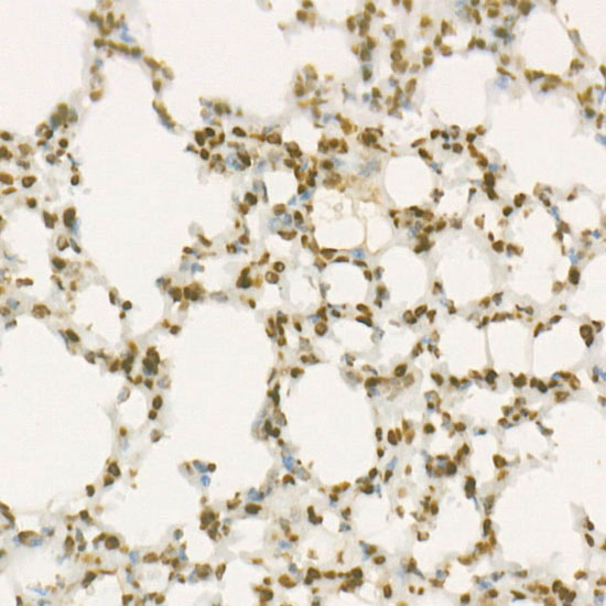 WEE1 Monoclonal Antibody [6V1Y6]