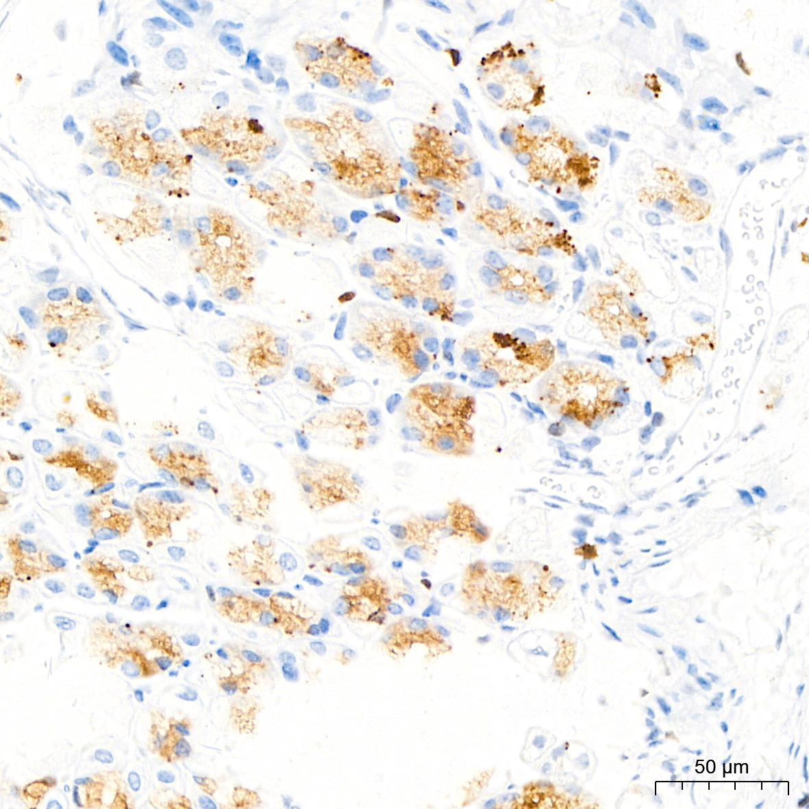 Pepsinogen II (PG II) Monoclonal Antibody [3M7P3]