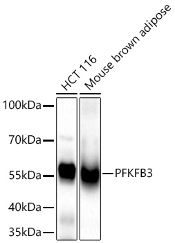 PFKFB3 Monoclonal Antibody