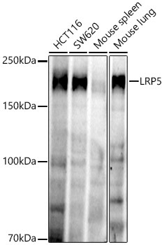 LRP5 Monoclonal Antibody [5N5M5]