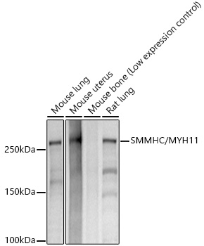 SMMHC/MYH11 Monoclonal Antibody