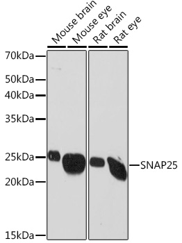 SNAP25 Monoclonal Antibody