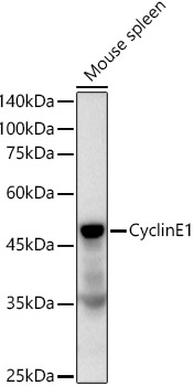 Cyclin E1 Monoclonal Antibody [7Z1D4]