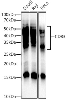 CD83 Monoclonal Antibody [5J2M8]