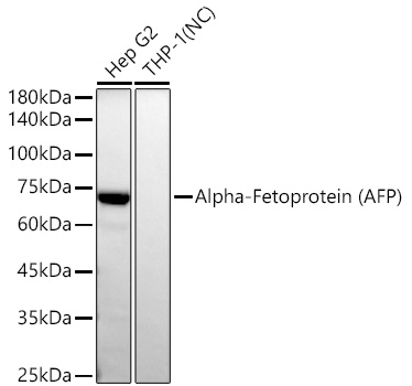 Alpha-Fetoprotein (AFP) Monoclonal Antibody