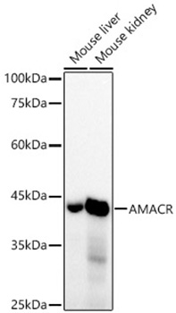 AMACR/p504S Monoclonal Antibody [4R3L10]
