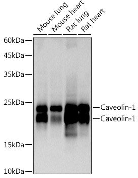 Caveolin-1 Monoclonal Antibody [9N5Z2]