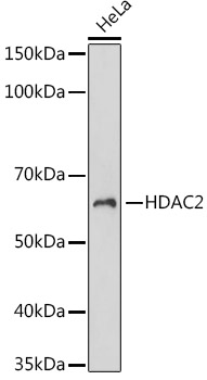HDAC2 Monoclonal Antibody [10D8W5]