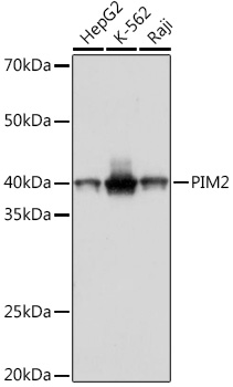 PIM2 Monoclonal Antibody [5K3V6]
