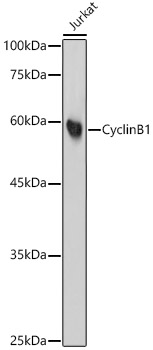 Cyclin B1 Monoclonal Antibody [6K2I5]