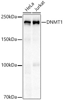 DNMT1 Monoclonal Antibody [0Y4N7]