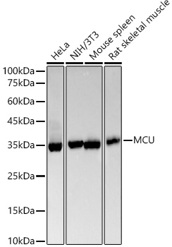MCU Monoclonal Antibody [5G2I5]