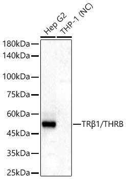 TRB1/THRB Monoclonal Antibody [6K1F1]