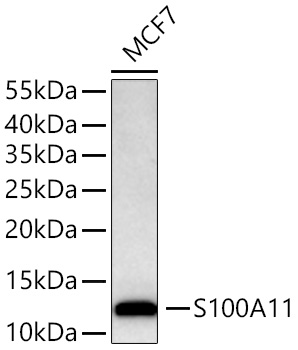 S100A11 Monoclonal Antibody [8U1Y8]