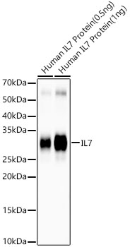 IL7 Monoclonal Antibody [3J8F3]