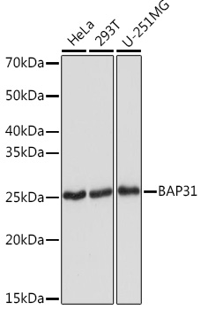 BAP31 Monoclonal Antibody [7R10K2]