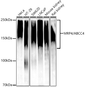 MRP4/ABCC4 Monoclonal Antibody [9W2S0]