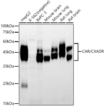 CAR/CXADR Monoclonal Antibody [6E0C5]