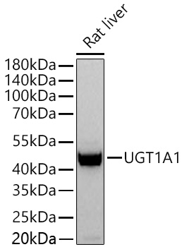 UGT1A1 Monoclonal Antibody [8U9P3]