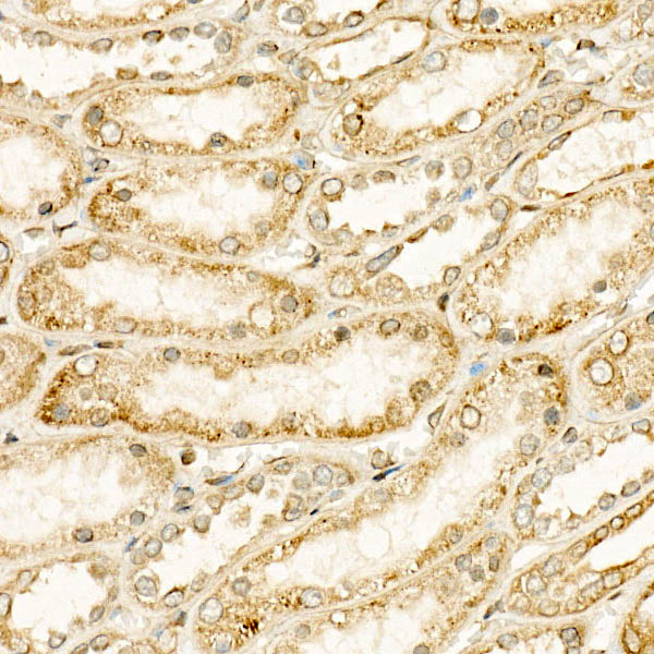 CYP24A1 Monoclonal Antibody [6X1U2]