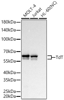 TdT Monoclonal Antibody [4Z3O3]
