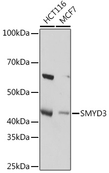 SMYD3 Monoclonal Antibody [2P8Z2]