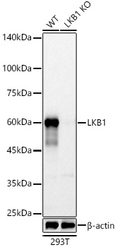 LKB1 Monoclonal Antibody [10S1C3]