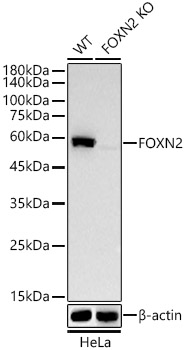 FOXN2 Monoclonal Antibody [9K7D9]