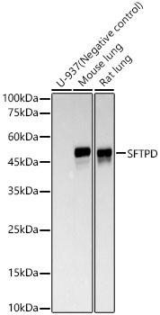 SFTPD Monoclonal Antibody [1X4V10]