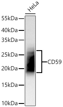 CD59 Monoclonal Antibody [6I7E9]