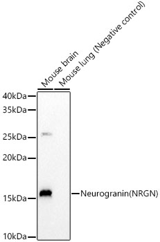 Neurogranin (NRGN) Monoclonal Antibody [9J7J6]